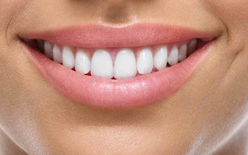 Diseño de Sonrisa: En qué consiste